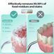 Ирригатор OasiSmile Water Flosser со сменными насадками G4499 фото 2